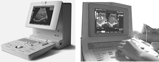 Портативные аппараты для УЗ исследований: слева – SonoAce-Pico; справа – Fukuda UF-750XT
