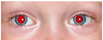 Фото для устранения эффекта красных глаз